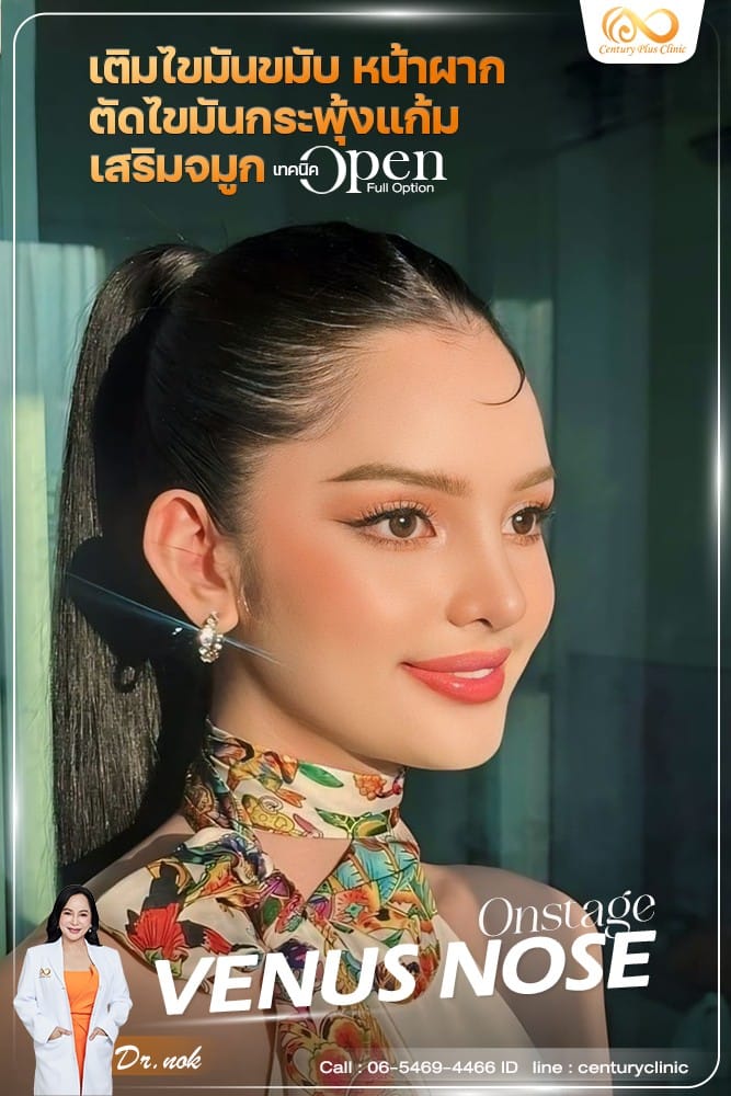 เสริมจมูก #1263