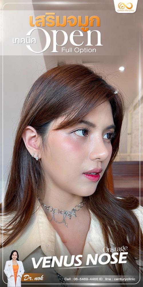 เสริมจมูก #1292