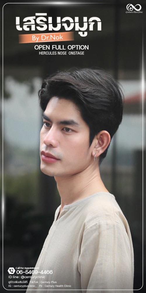 เสริมจมูก #1311