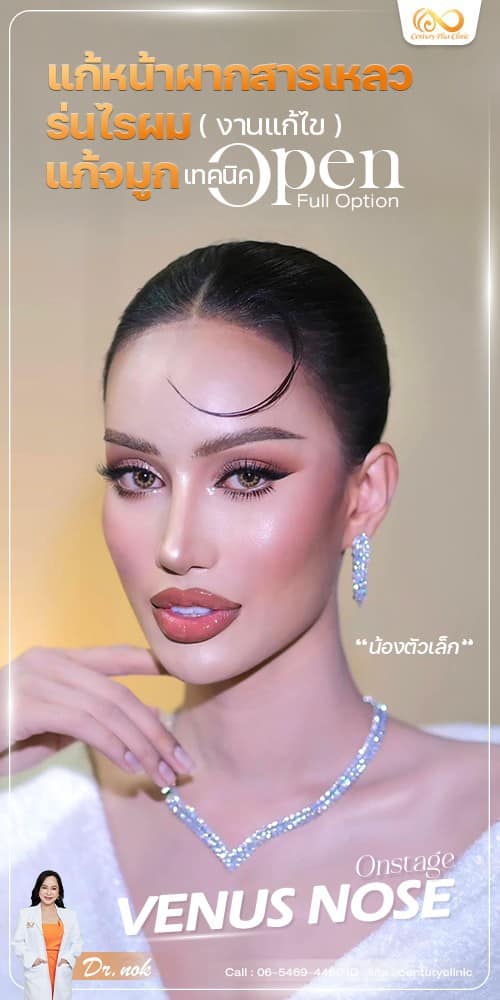 แก้จมูก #1255