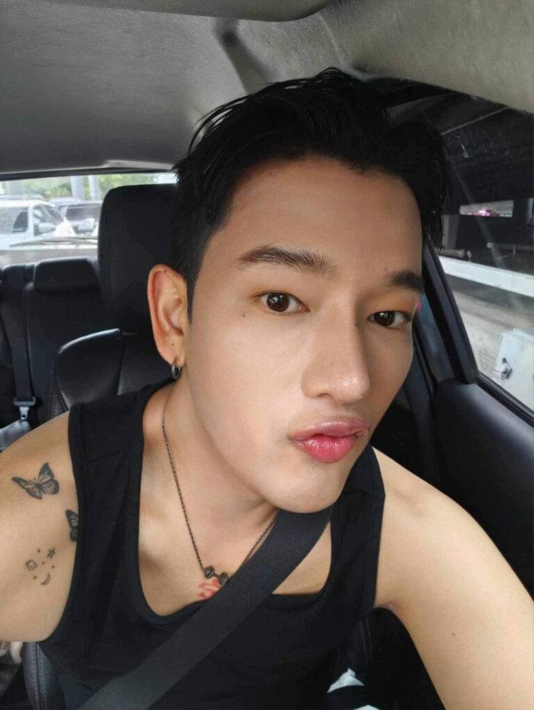 แก้จมูก #1271