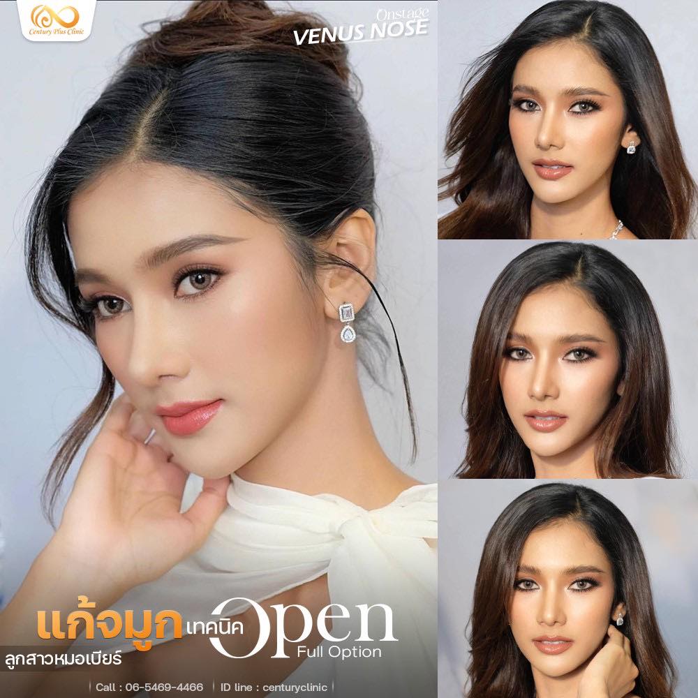 แก้จมูก #1281