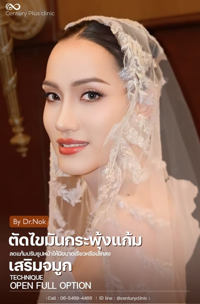 เสริมจมูก #1362