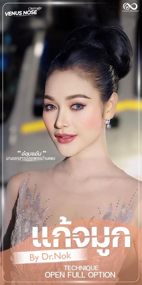 แก้จมูก #1326