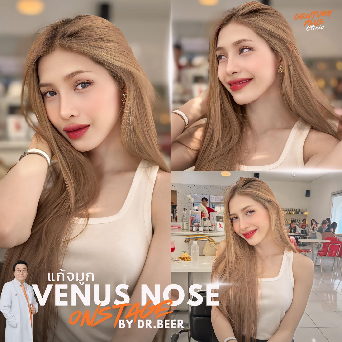 รีวิว แก้จมูก #1329 , Century Clinic Thailand แก้จมูก #1329