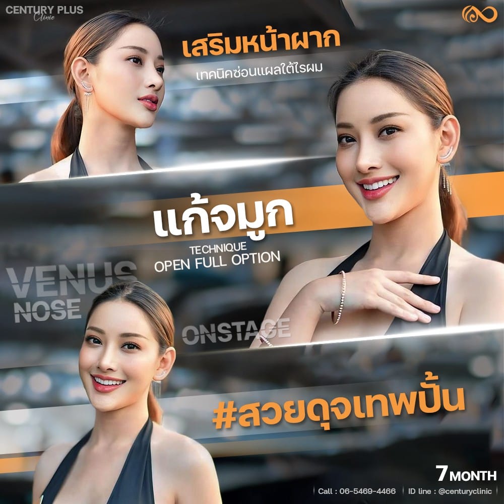 แก้จมูก #1339