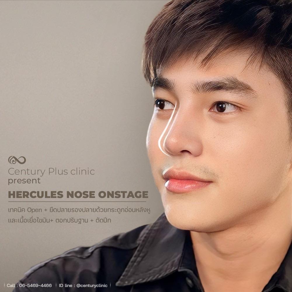แก้จมูก #1340