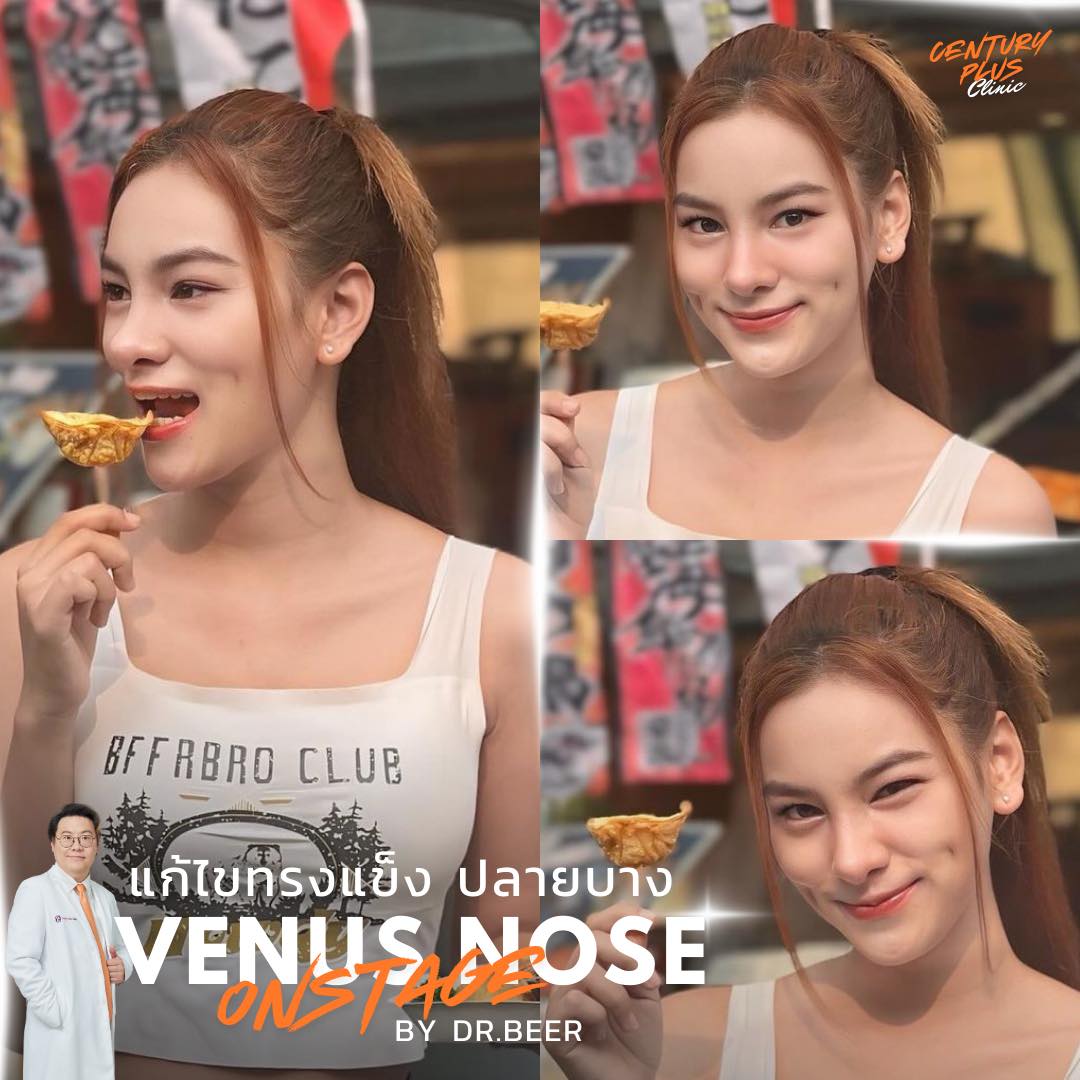 แก้จมูก #1355