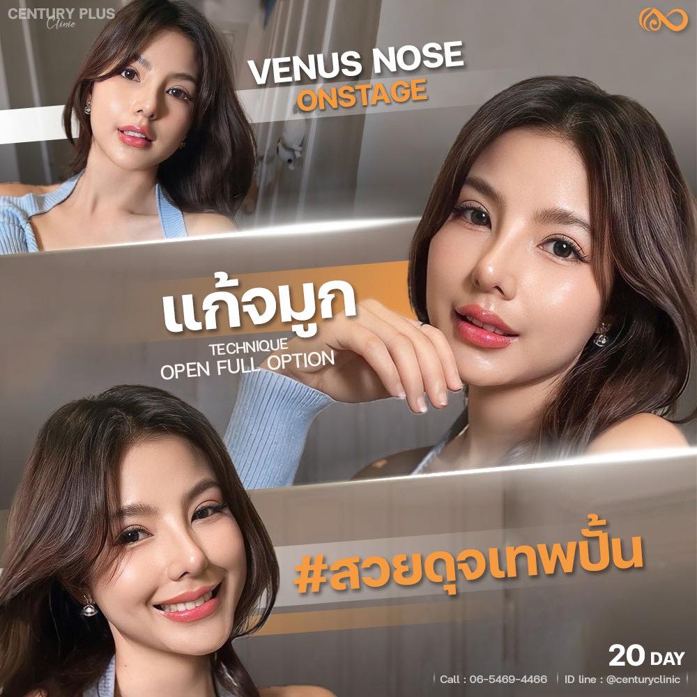 แก้จมูก #1360