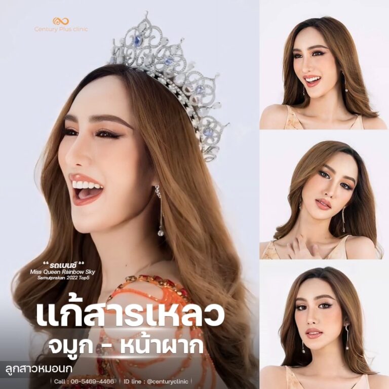 แก้จมูก #1368