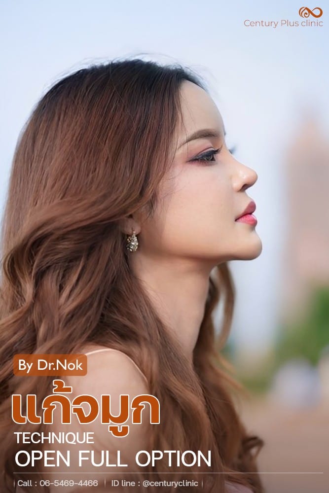 แก้จมูก 2#1359
