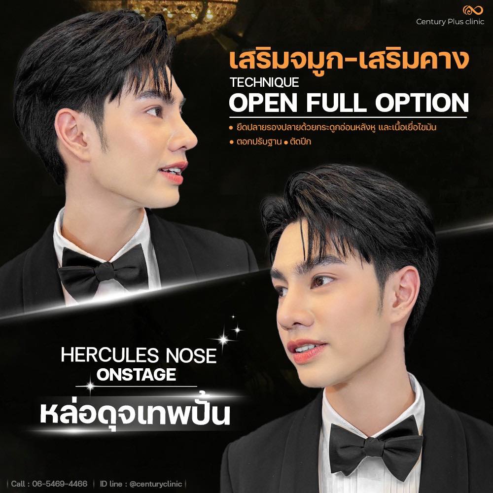เสริมจมูก #1371