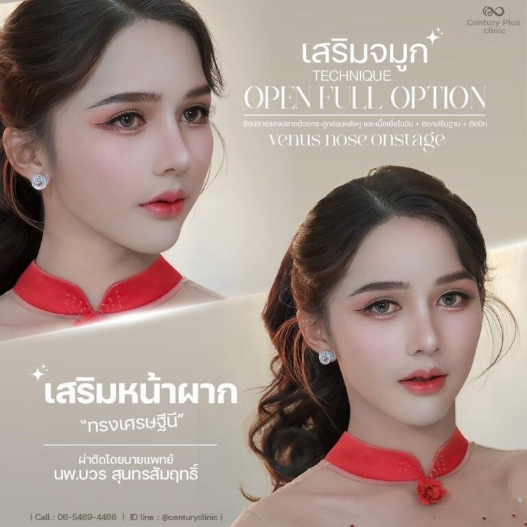 เสริมจมูก #1397