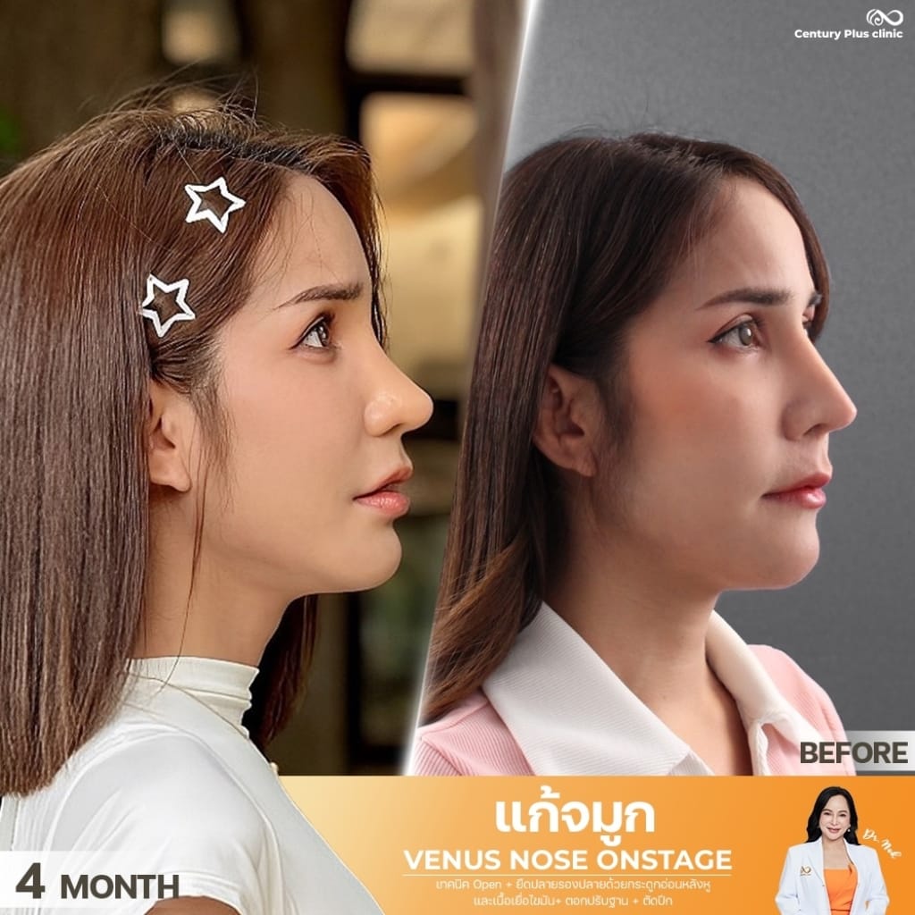 Century Clinic Thailand