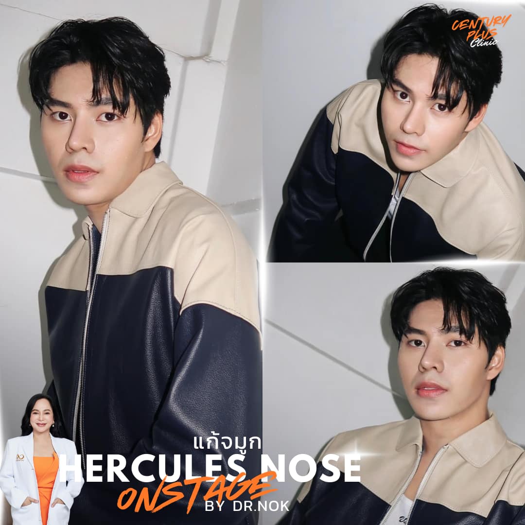 รีวิว แก้จมูก #1407 , Century Clinic Thailand แก้จมูก #1407