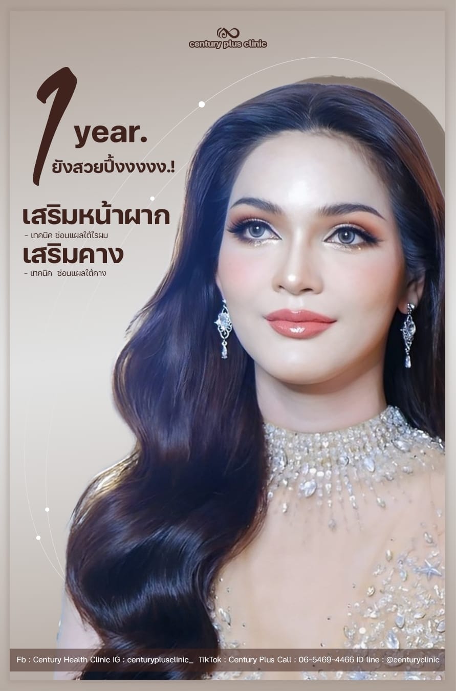 เสริมหน้าผาก #48